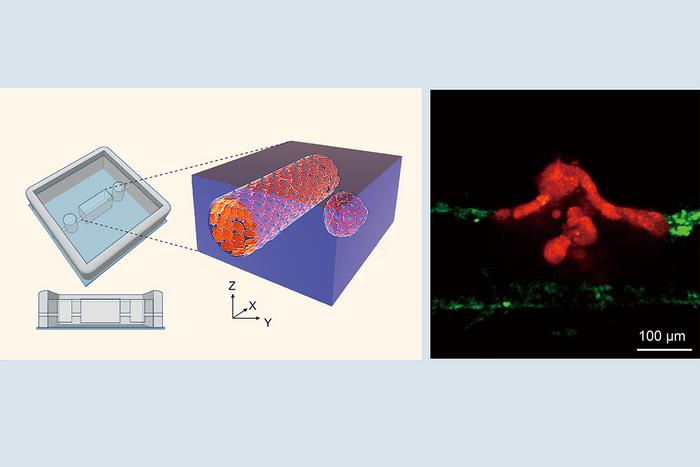new-in-vitro-cancer-model-uncovers-how-tumor-cells-enter-the-bloodstream