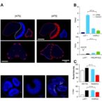 fucosyltransferase-11-inhibits-ferroptosis-in-gastric-cancer