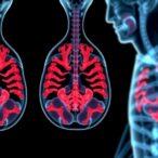 sarcopenia-predicts-cancer-mortality:-new-models