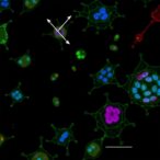 boosting-stem-cell-derived-islet-survival-in-hypoxia