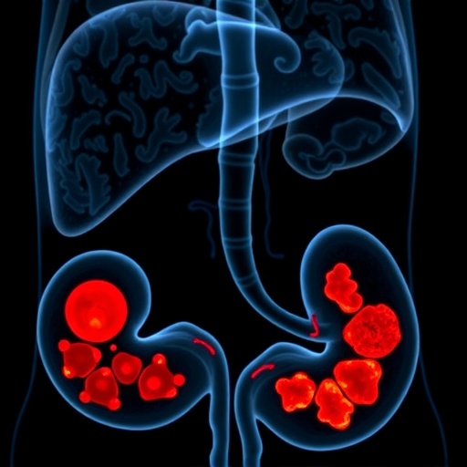 hepatic-lesion-count-predicts-cholangiocarcinoma-outcomes
