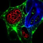 hnrnpl-drives-pik3cb-activation,-boosts-ovarian-cancer-glycolysis
