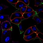 jak1/2-inhibition-fights-mpns-without-blocking-oncogenes
