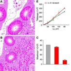 novel-il-41-marker-predicts-liver-cancer-prognosis