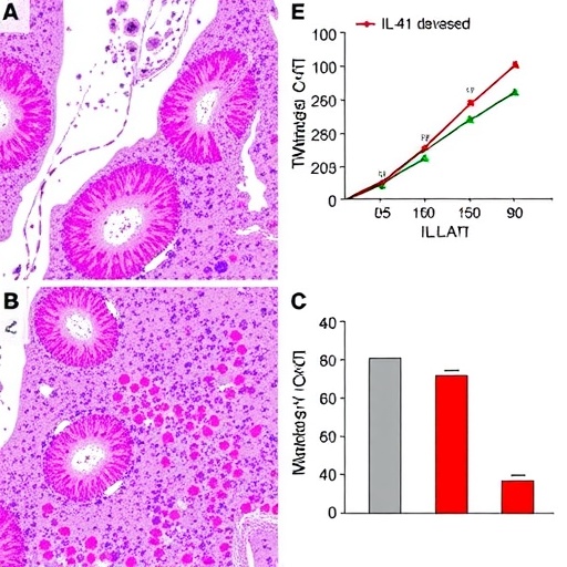 novel-il-41-marker-predicts-liver-cancer-prognosis