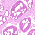 histogpt-creates-dermatopathology-reports-from-whole-slides