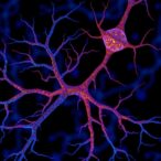 co-protects-neurons-by-activating-perk-pathway