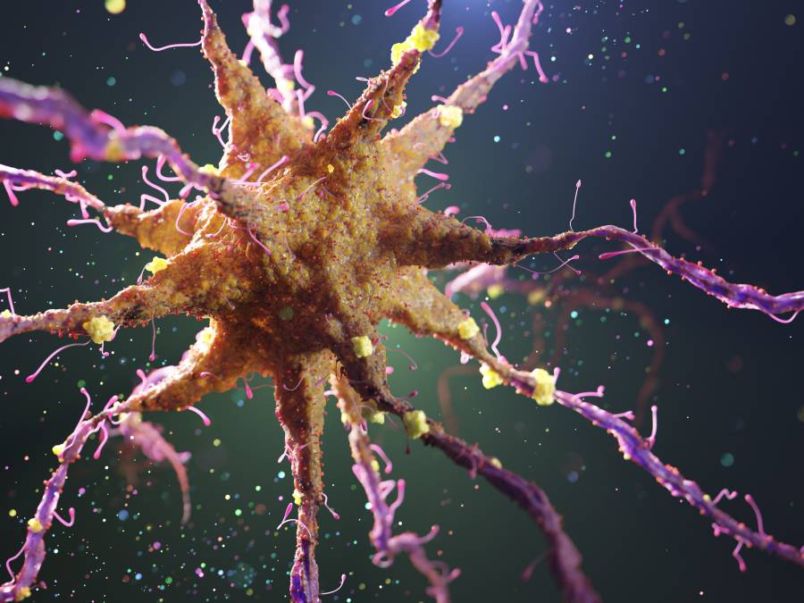 movement-mobilizes-microglia,-astrocytes-to-protect-against-alzheimer’s-in-snrna-seq-mice-study