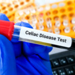 celiac-disease-detection-made-easier-with-t-cell-reactivity-test
