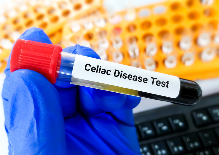 celiac-disease-detection-made-easier-with-t-cell-reactivity-test