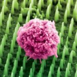 millions-of-nanoneedles-poised-to-replace-painful-cancer-biopsies
