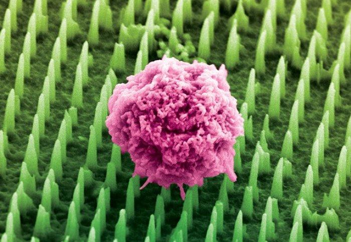 nanoneedle-patch-could-offer-alternative-to-painful-tissue-biopsies