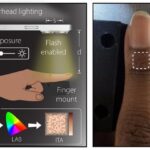 smartphones-enhance-medical-device-accuracy-across-diverse-skin-tones