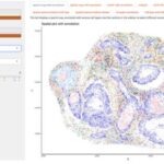 revolutionary-tacit-algorithm-heralds-new-era-in-cancer-diagnosis-and-treatment