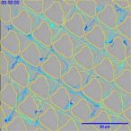 scientists-unveil-innovative-material-maze-to-block-bacterial-infections