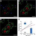 dual-viral-bacterial-trigger-activates-mmp7-in-biliary-atresia