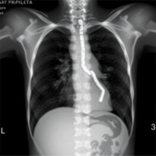 assessing-lung-function-in-congenital-diaphragmatic-hernia