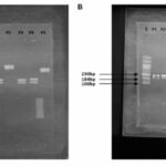 cost-effective-genetic-testing-advances-early-detection-of-prostate-cancer