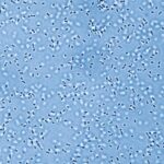 pandora’s-microbes:-unraveling-the-lung’s-iron-war
