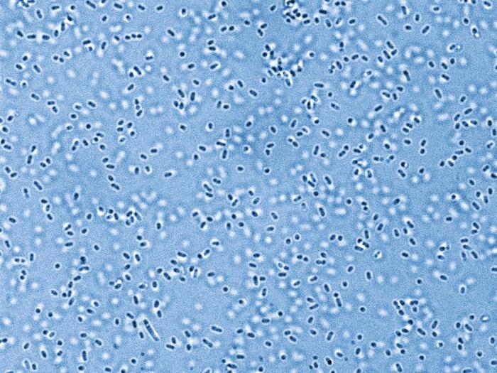 pandora’s-microbes:-unraveling-the-lung’s-iron-war