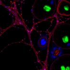 oncogenic-mirnas-control-map-kinase-regulator-dusp2