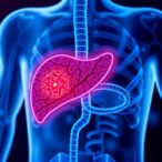 targeting-cell-death-to-combat-early-liver-cancer