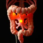 organoid-model-reveals-residual-colorectal-cancer-stem-cells