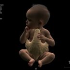 tbx4-deficiency-causes-infant-lung-issues,-hypertension
