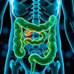 cell-therapy-enhances-survival-rates-in-colorectal-cancer-patients