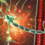 organ-chip-als-model-uses-patient-ipscs-to-uncover-early-disease-progression