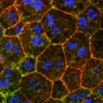 age-related-macular-degeneration-slowed-by-increasing-apolipoprotein-m