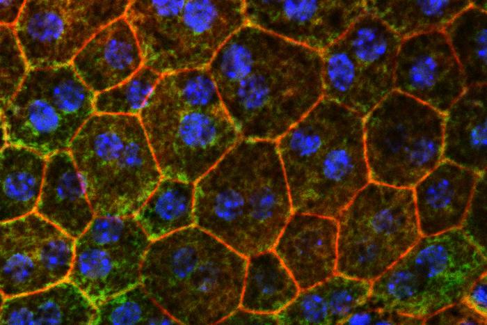 age-related-macular-degeneration-slowed-by-increasing-apolipoprotein-m