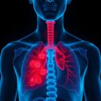 the-impact-of-depression-and-inflammation-on-lung-cancer-patients:-a-dangerous-duo