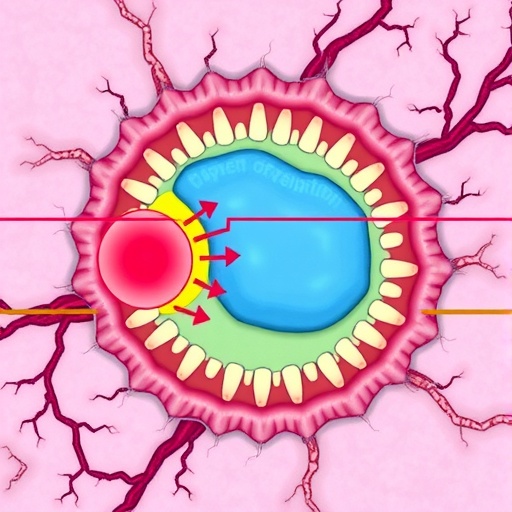 fibroblast-lipid-metabolism-controls-gut-cell-ferroptosis