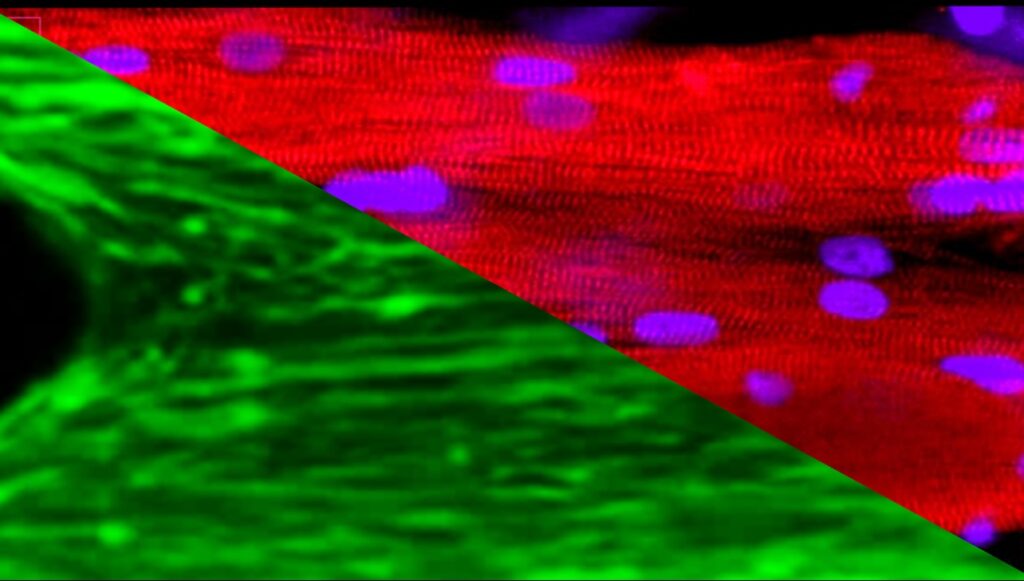 space-station’s-lab-on-chip-model-uncovers-how-microgravity-drives-muscle-degeneration