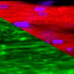 space-station’s-lab-on-chip-model-uncovers-how-microgravity-drives-muscle-degeneration