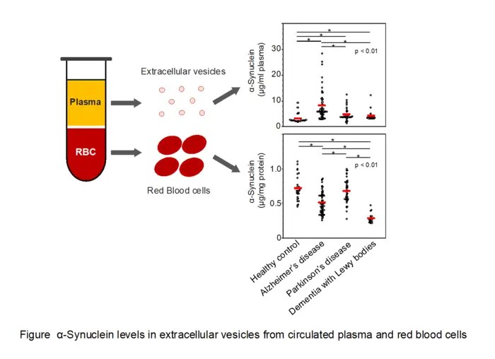 reduced-α-synuclein-levels-found-in-red-blood-cells-of-dementia-with-lewy-bodies-patients