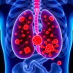 new-study-uncovers-how-common-mutation-drives-prostate-cancer-development