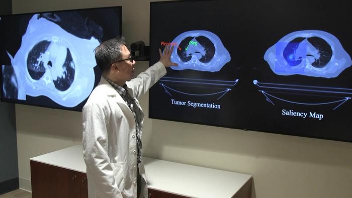ai-rivals-doctors-in-precision-mapping-of-lung-tumors-for-radiation-therapy