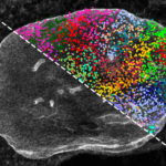 spatial-technology-unveils-genome-structure-associated-with-aging
