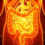 diosmetin-targets-inf2:-new-colorectal-therapy