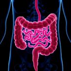 cholesterol-fuels-colorectal-cancer:-gut-microbiota-and-simvastatin-counteract