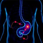 biosensors-revolutionize-gastrointestinal-tumor-detection