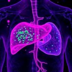histotripsy-activates-immune-response-to-target-cancer-cells-beyond-the-liver