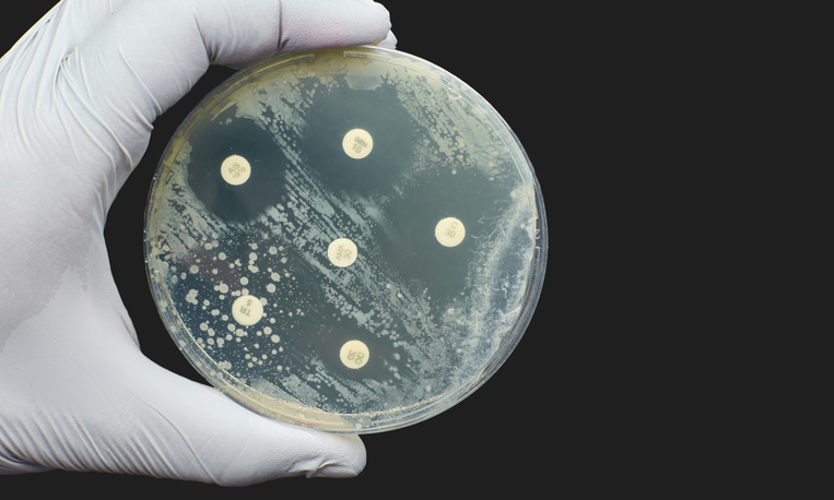 amr-may-meet-its-match:-new-compound-shows-preclinical-promise