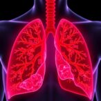 inflammation-predicts-immunotherapy-success-in-lung-cancer