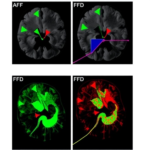 fgfr-inhibition-boosts-glioblastoma-stem-cell-sensitivity