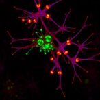intracellular-amyloid-s-marks-vulnerable-neurons-in-alzheimer’s