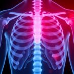 loss-of-y-chromosome-linked-to-worse-cancer-prognosis