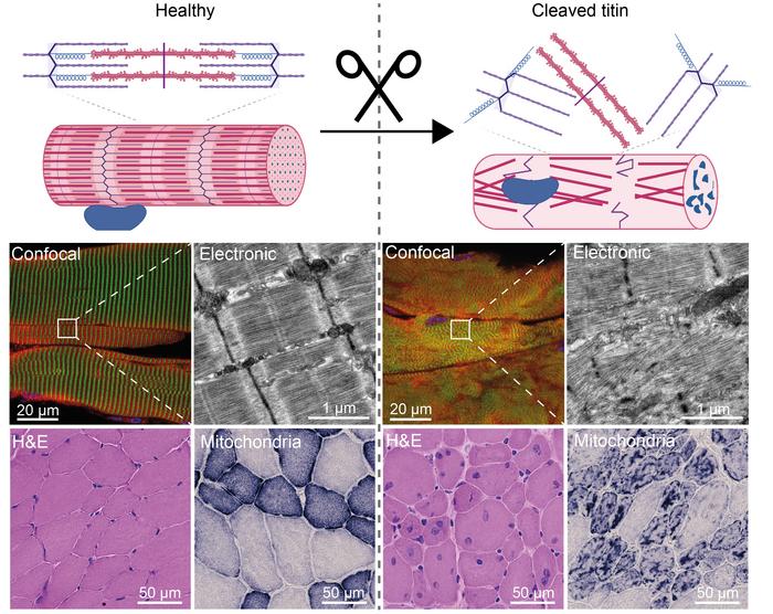 innovative-technique-unveils-role-of-mechanical-proteins-in-muscular-disorders
